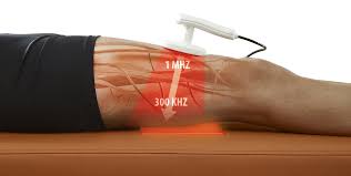 What is diathermy?